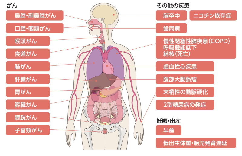 タバコによる健康被害について。タバコがヒトの体の部位にどのような被害をもたらすか表しており、がん、その他の疾患、妊娠・出産の3種に分類されている。